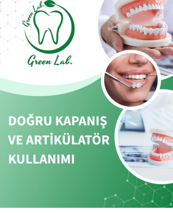 DOĞRU KAPANIŞ