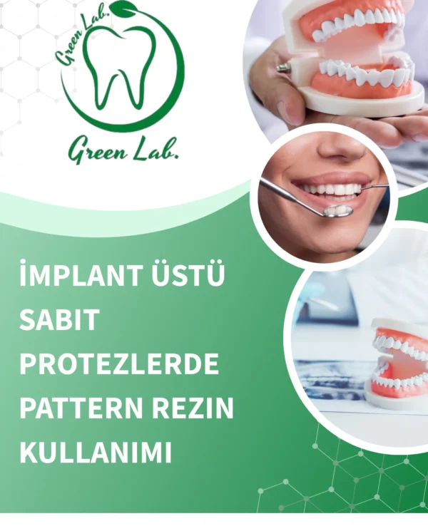 İmplant Üstü Sabit Protezlerde Pattern Rezin Kullanımı ve Pasif Uyumun Önemi